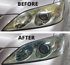 SONAX Profiline Headlight Restoration Kit | Complete DIY Headlight Repair & Protection | Removes Yellowing, Foggy Haze & Oxid