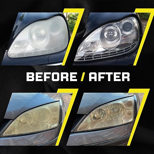 Headlight Restoration Kit – Oxidation & Yellowing Remover with UV Sealant | Wipes + 2000/3000 Sanding Discs + 3” Holder, Glov
